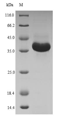Human MBTPS1 / S1P Protein (Recombinant 6His-SUMO, N-terminus)