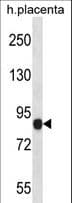 Polyclonal Rabbit anti-Human NALP6 / NLRP6 Antibody (aa168-197, WB)