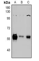 Polyclonal Rabbit anti-Human PINK1 Antibody (WB)