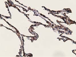ADH2 / ADH1B Antibody (clone OTI4F12)