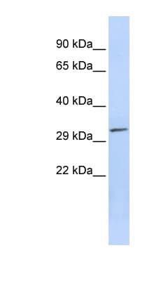 PDXP / Pyridoxal Phosphatase Antibody (aa179-228)