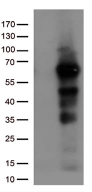 Monoclonal Mouse anti-Human IRF3 Antibody (clone OTI2G6, aa27-169, IF, WB)