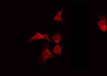 ADD1 / Adducin Alpha Antibody