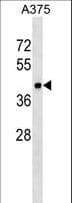 METAP1 Antibody (aa188-216)