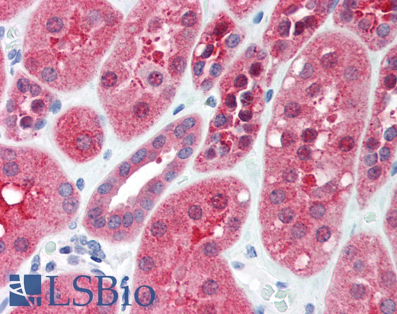 IHC-plus™ GGA2 Antibody