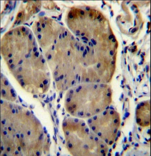 Polyclonal Rabbit anti-Human WDR86 Antibody (aa286-316, IHC, WB)