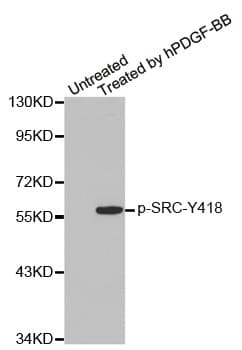 SRC Antibody (phospho-Tyr418)