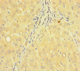 Polyclonal Rabbit anti-Human ACTR5 / ARP5 Antibody (IHC, IF)