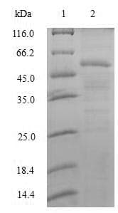 Human U2AF1 Protein (Recombinant GST, N-terminus)