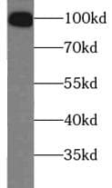 VR1 / TRPV1 Antibody