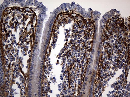 TGFBI Antibody (aa405-683, clone OTI9A11)