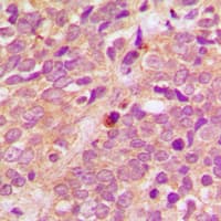 PRKD1 + PRKD2 + PRKD3 Antibody (phospho-Ser738/742)