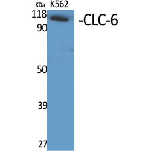 CLCN6 Antibody (580-660 aa, Internal)