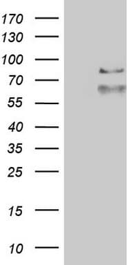 ALDP / ABCD1 Antibody (aa508-745, clone OTI2E9)