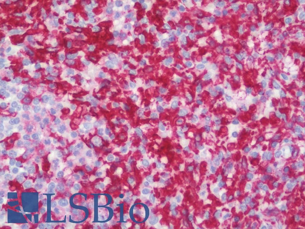 IHC-plus™ Polyclonal Rabbit anti-Human FCER1G Antibody (aa60-86, IHC, WB)