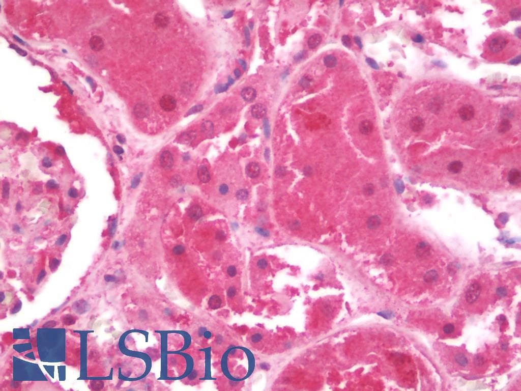 IHC-plus™ Polyclonal Rabbit anti-Human ARSB / Arylsulfatase B Antibody (IHC, IF, WB)