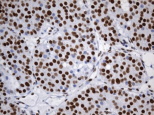 Monoclonal Mouse anti-Human RING1 Antibody (clone OTI11G7, aa88-362, IHC, WB)