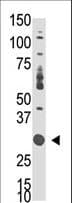 DOK5 Antibody (aa276-306)