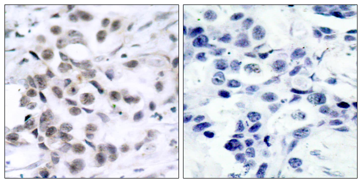 CHEK1 / CHK1 Antibody (aa286-335)