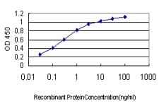 CA1 / Carbonic Anhydrase I Antibody (clone M2)