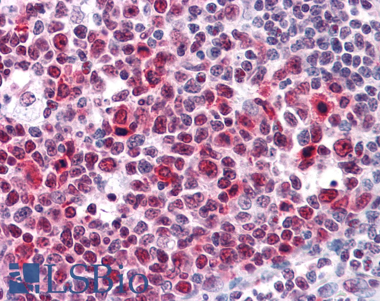 IHC-plus™ Monoclonal Mouse anti-Human HMG2 / HMGB2 Antibody (clone 3D2, IHC, IF, WB)