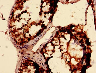 RBKS / Ribokinase Antibody