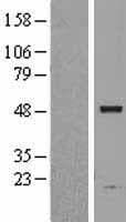 ASAH1 / Acid Ceramidase Protein (Over-Expression Lysate Myc-DDK (Flag))