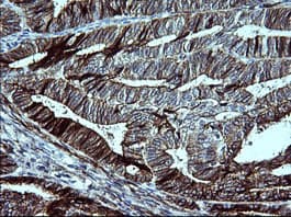 CDH3 / P-Cadherin Antibody (clone 2D5, Carrier-free)