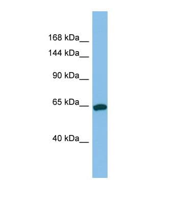 TPO / Thyroid Peroxidase Antibody (aa167-216)