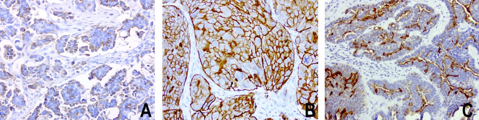 EMA / MUC1 Antibody (clone UMAB57)