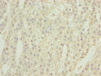 Polyclonal Rabbit anti-Human GEMIN6 / Gemin-6 Antibody (IHC)