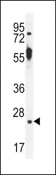 TTC9B Antibody (aa177-206)