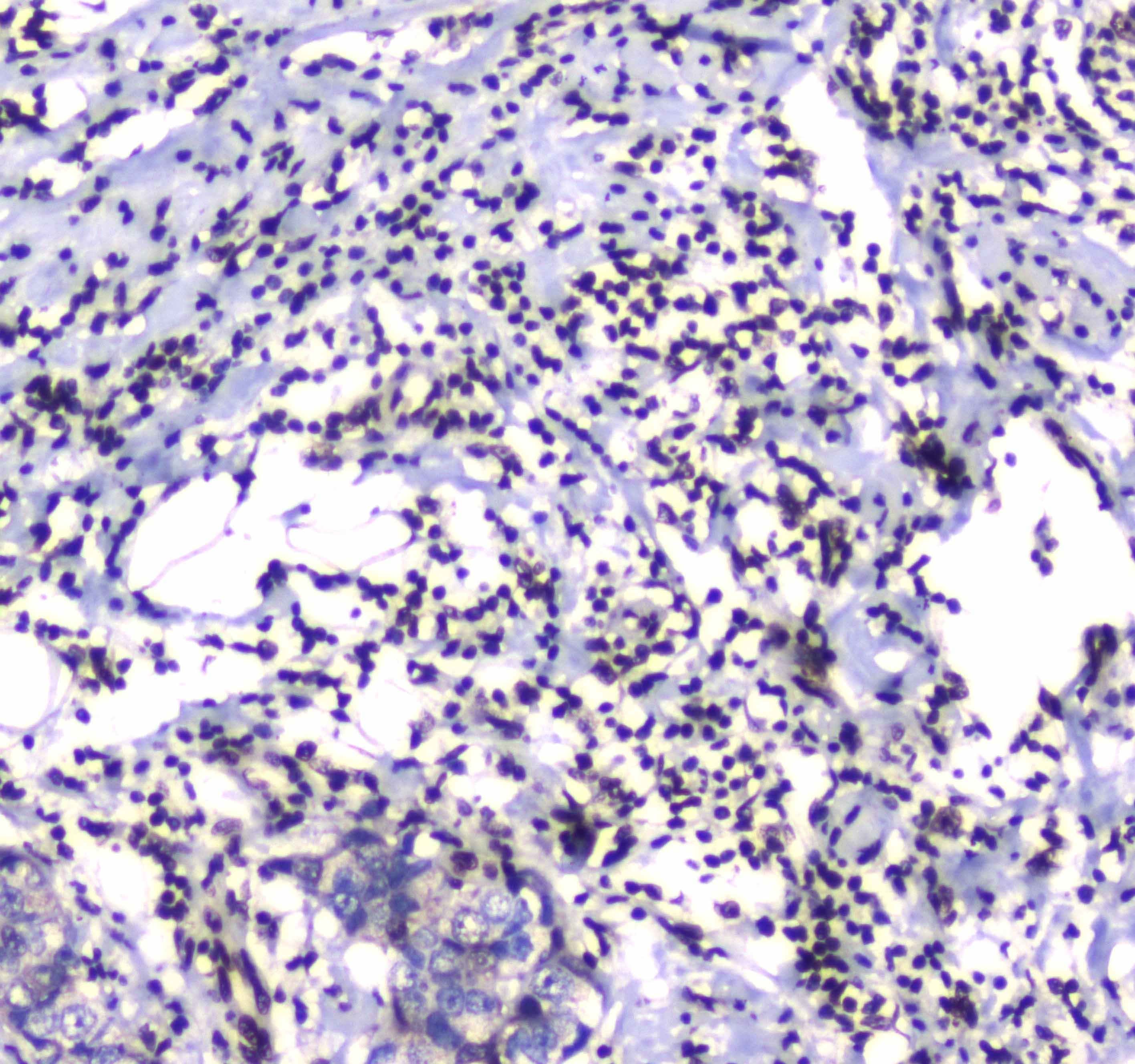 Polyclonal Rabbit anti-Human GFI1 Antibody (IHC)