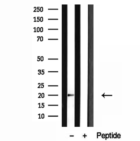CETN1 Antibody
