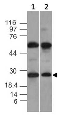 KCNIP1 / KCHIP1 Antibody