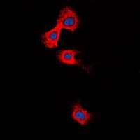 MMP11 Antibody (Internal)