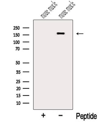 MYOM3 Antibody