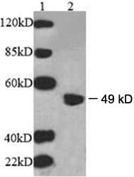 B3GALTL Antibody