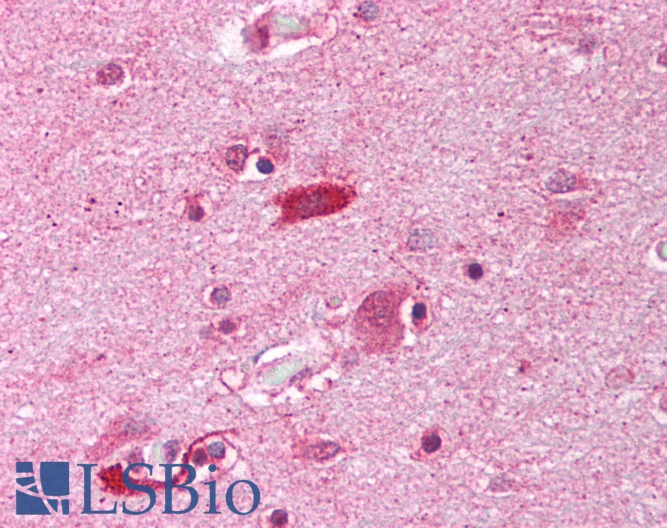 IHC-plus™ HAP1 Antibody