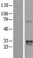 HLA-DQA1 Protein (Over-Expression Lysate Myc-DDK (Flag))