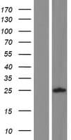 ALG1L Protein (Over-Expression Lysate Myc-DDK (Flag))