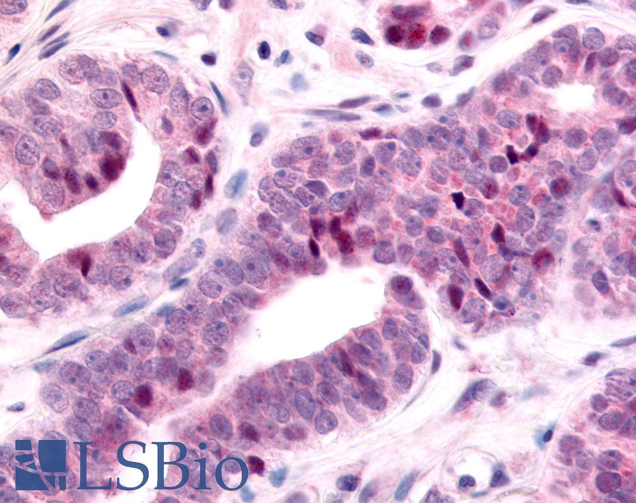 PathPlus™ NR2E1 / TLX Antibody (N-Terminus)
