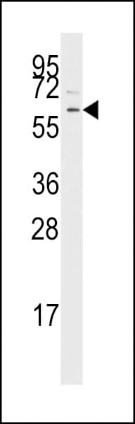 Polyclonal Rabbit anti-Human TGFBR1 / ALK5 Antibody (aa134-163, IHC, WB)
