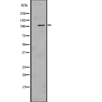 ADGRE1 / EMR1 Antibody (aa826-876)