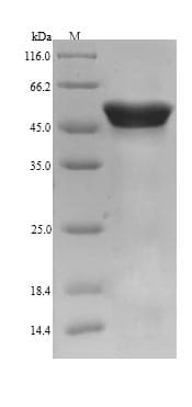 Pig CALR / Calreticulin Protein (Recombinant 6His, N-terminus)