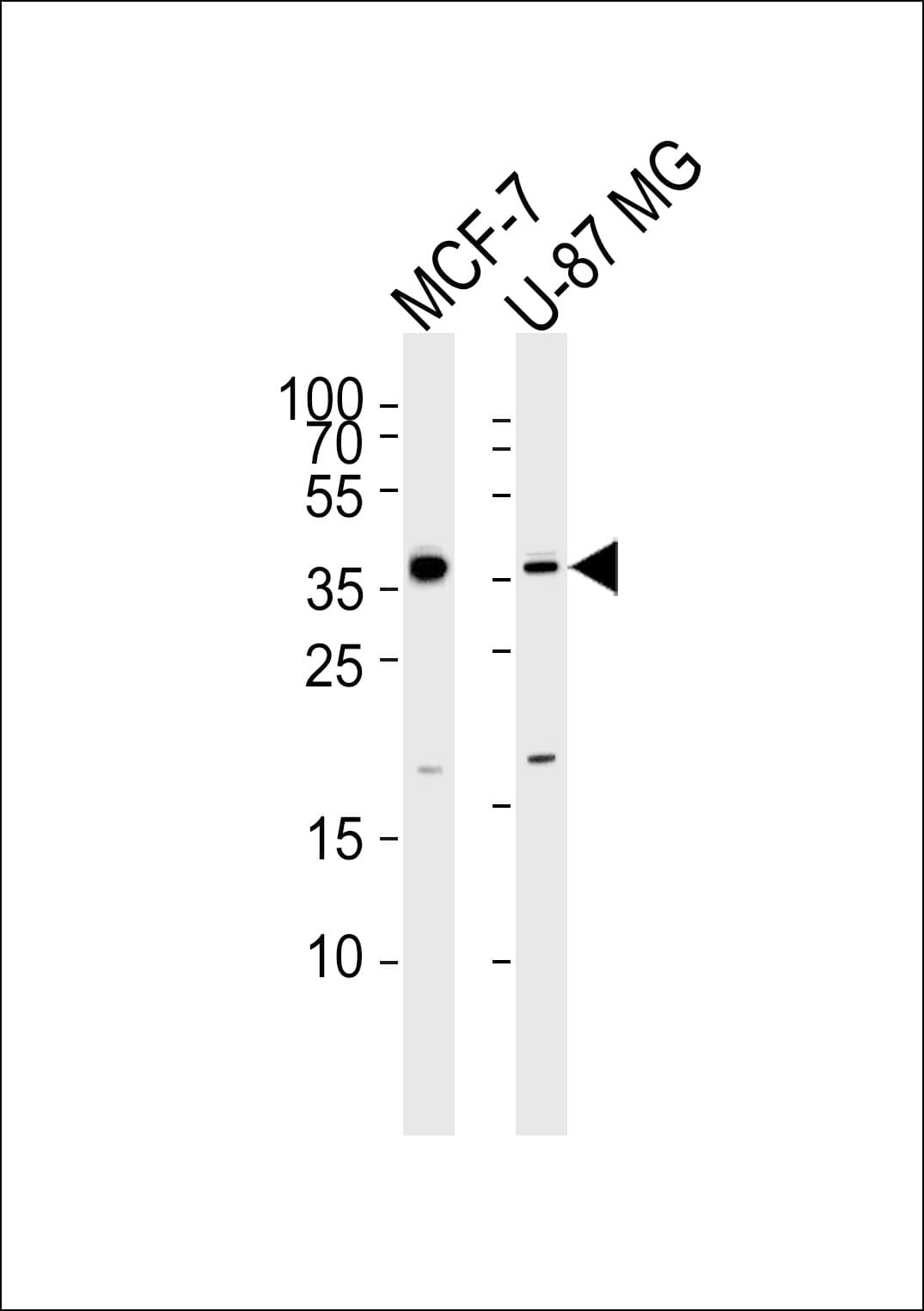 Polyclonal Rabbit anti-Human KCTD4 Antibody (aa160-191, WB)