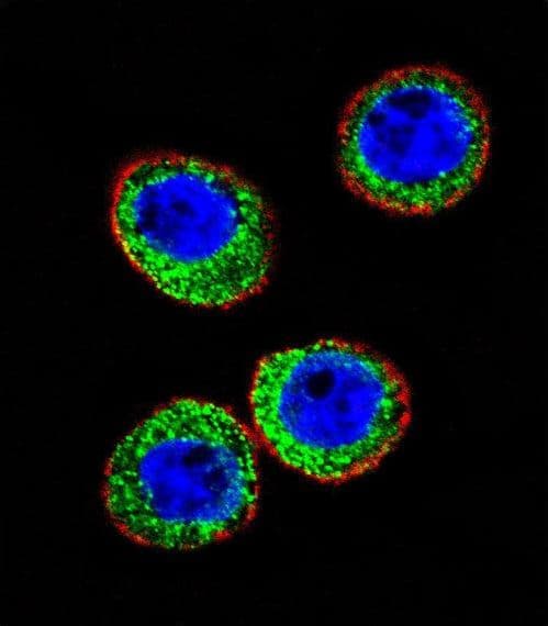 IHC-plus™ Polyclonal Rabbit anti-Human MME / CD10 Antibody (aa274-302, IHC, IF, WB)