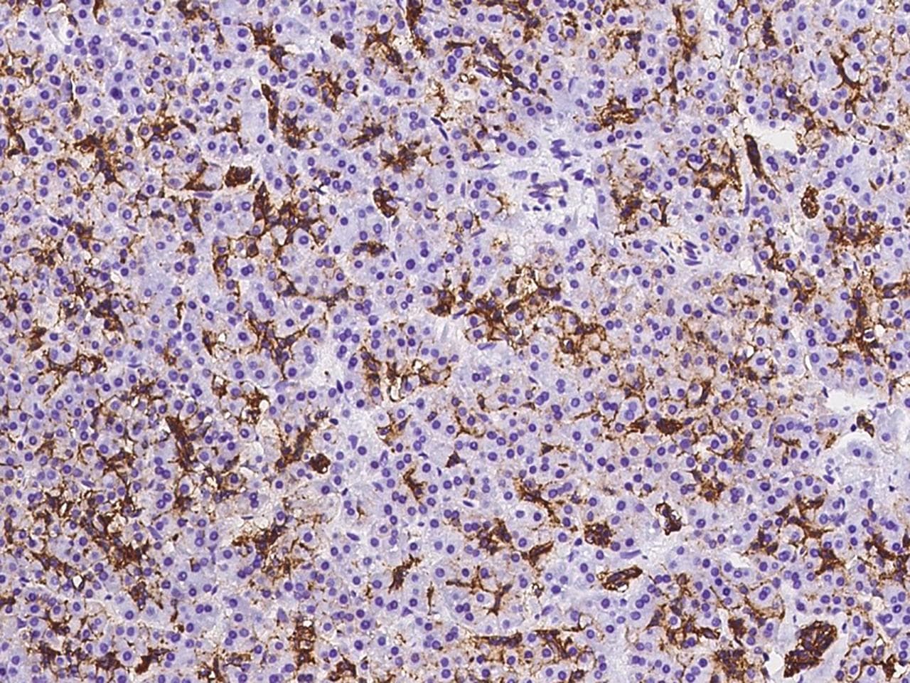 Polyclonal Rabbit anti-Human AQP1 / Aquaporin 1 Antibody (IHC)