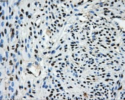 Monoclonal Mouse anti-Human LOX / Lysyl Oxidase Antibody (clone OTI6B11, IHC, IF, WB)