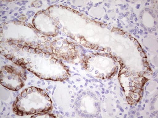PKD3 / PRKD3 Antibody (aa300-508, clone OTI4G6)